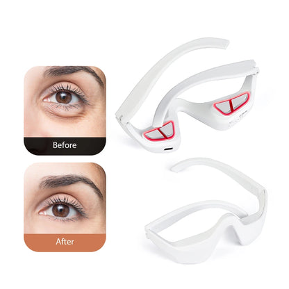 3D Eye Massager – Dark Circle & Fatigue Relief